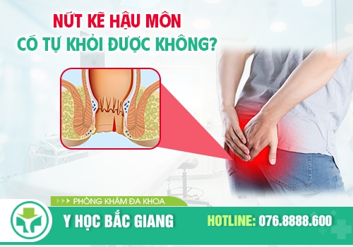 Nứt kẽ hậu môn có tự khỏi không? Những điều bạn cần biết để trị hiệu quả